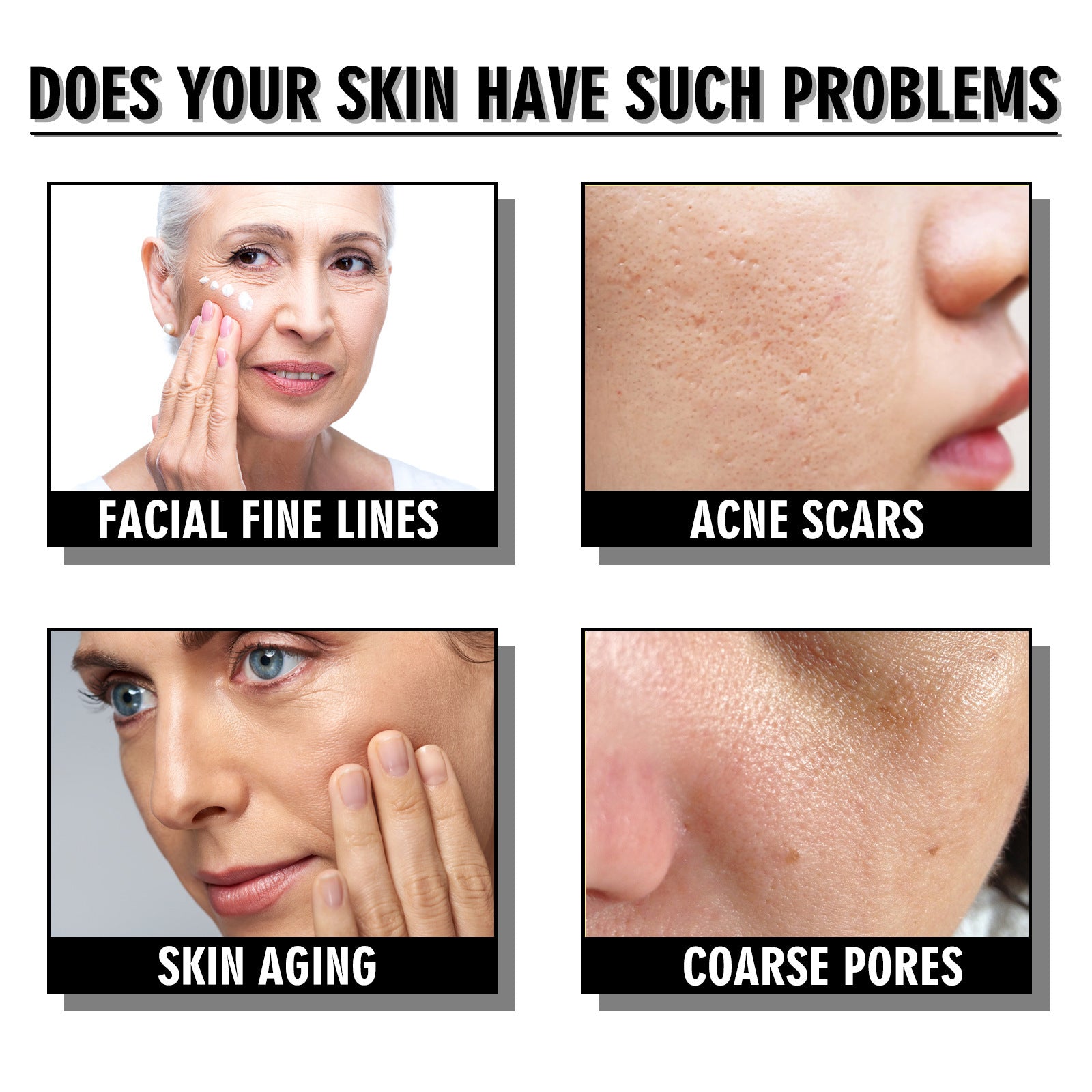 Snail Cream Fading Wrinkle French Lines Replenishment Firming Skin Anti-Aging Snail Cream Fading Wrinkle French Lines Replenishment Firming Skin Anti-Aging